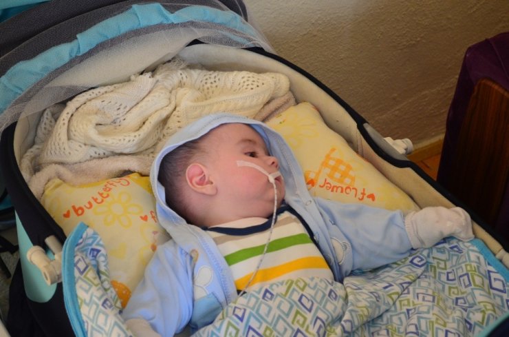 Şizensefali hastası bebeğin ailesi yardım bekliyor