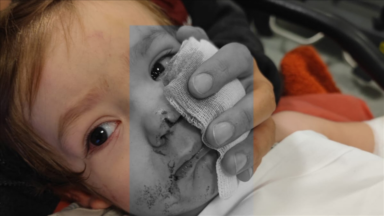 Etimesgut’ta pitbull saldırısı: Köpek sahibi tutuklandı, çocuklar hastaneye kaldırıldı