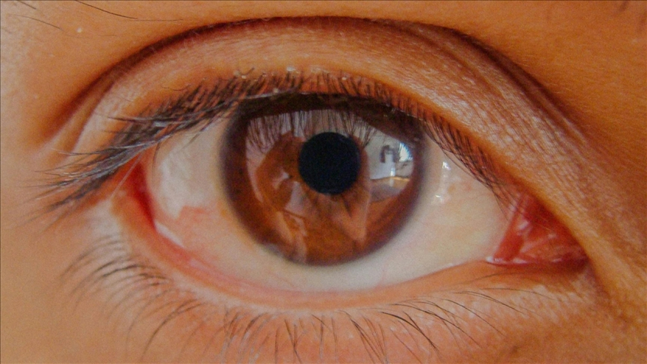 Glokomda erken teşhis kalıcı görme kaybını engelliyor