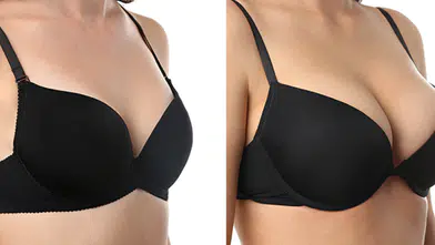 Meme Büyütme ile İdeal Görünüme Yolculuk: Dr. Mehmet Uzuner Rehberliğinde Estetik Bir Başlangıç