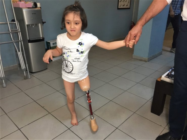 Minik Özge’nin protez bacak mutluluğu